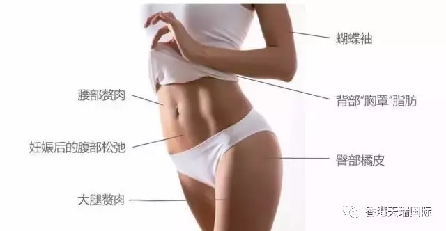現(xiàn)下流行的BTL脂肪刀，有什么效果？