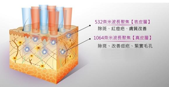 祛痘我用點(diǎn)陣，你呢？！