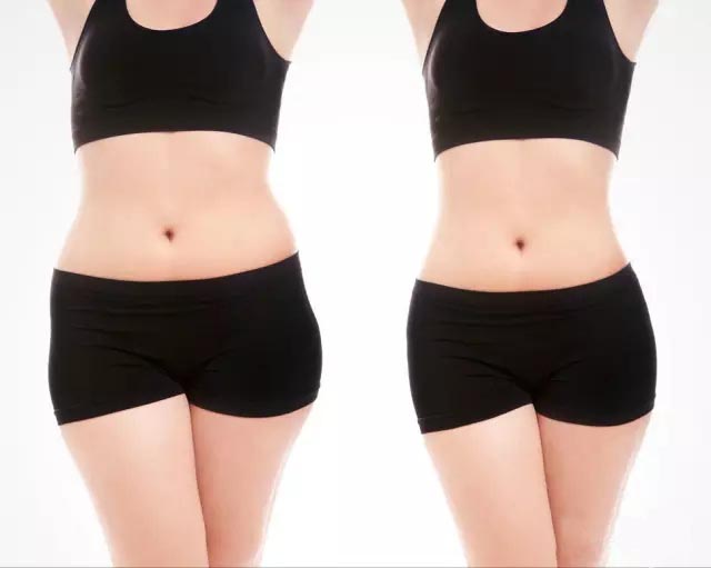 UltraShape優(yōu)立塑非侵入式專利科技、有效、安全！
